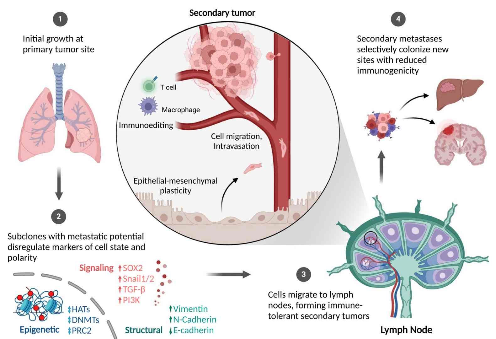 Cellular state destabilization, migratory activation, and metastatic dissemination (Kiri & Tyrone, 2024)